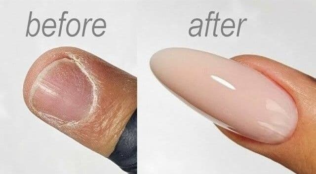 Nagelmodellage Gel / Tip